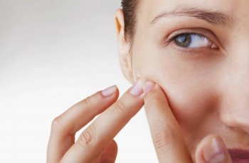 Acne depois dos 20 anos: por que ela aparece na vida adulta?